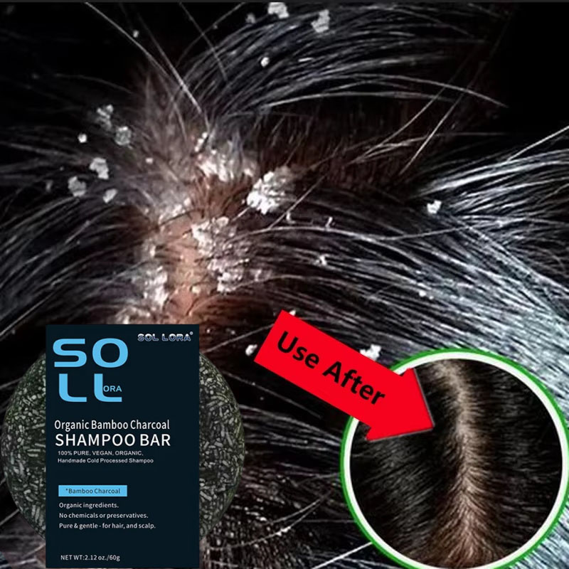 Fast Anti Dandruff Hair Treatm - Castor Oil Soap recension och pris